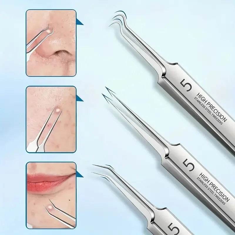 Clinical Blackhead Remover